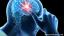Kaj vedeti o epilepsiji in duševnem zdravju